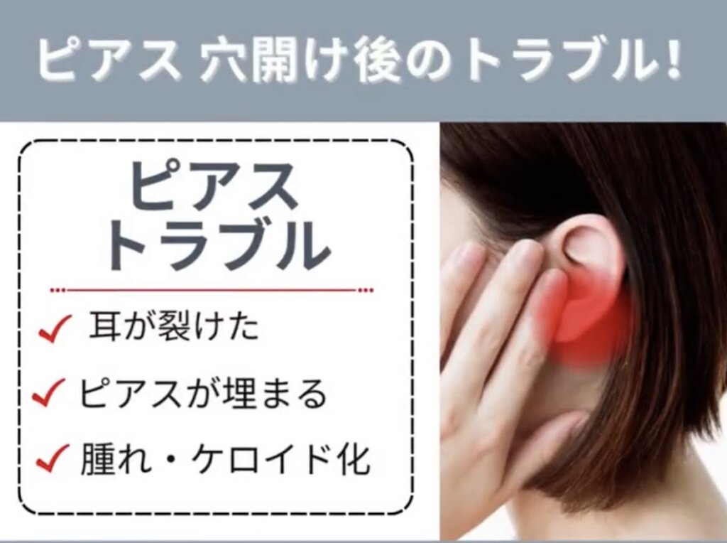 ピアストラブル